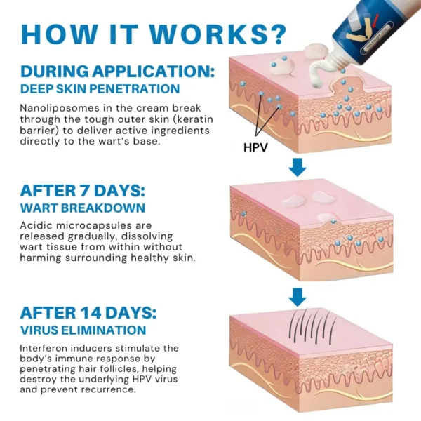 Fivfivgo® EXTRA HPV Genital Warts Relief Cream