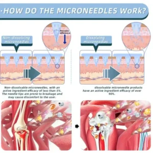 Fivfivgo® Nano-Microneedle Joint Patch
