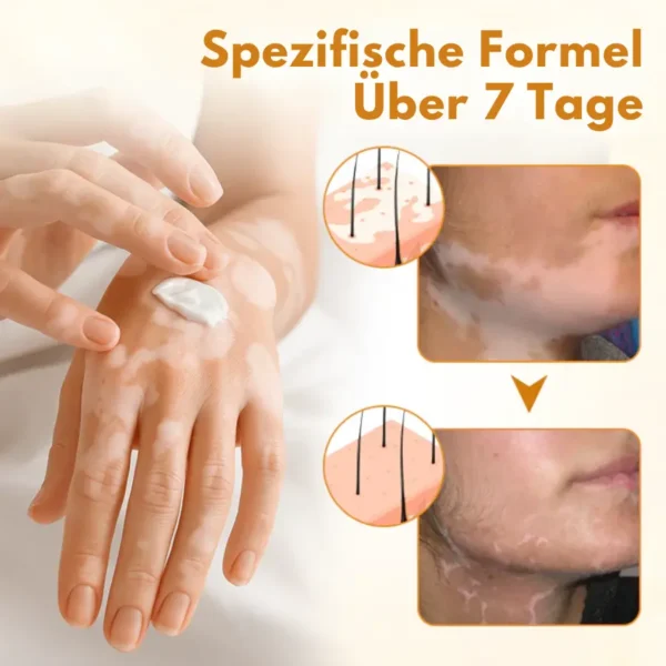 Fivfivgo® VitiCalm Bienengift-Creme