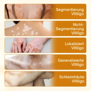 Fivfivgo® VitiCalm Bienengift-Creme