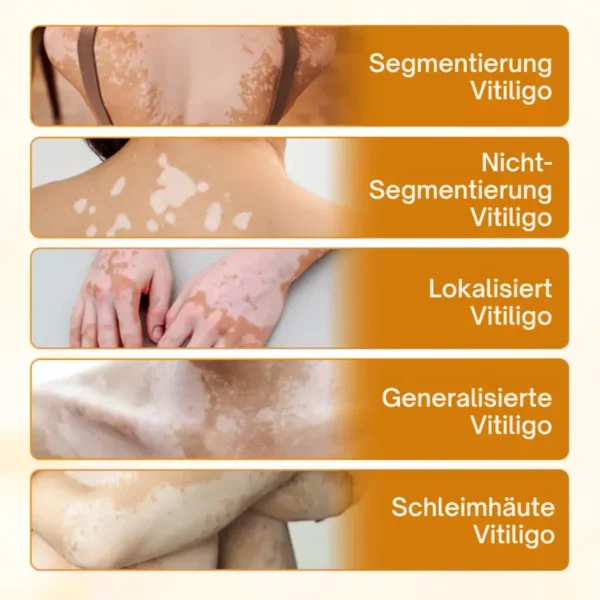 Fivfivgo® VitiCalm Bienengift-Creme
