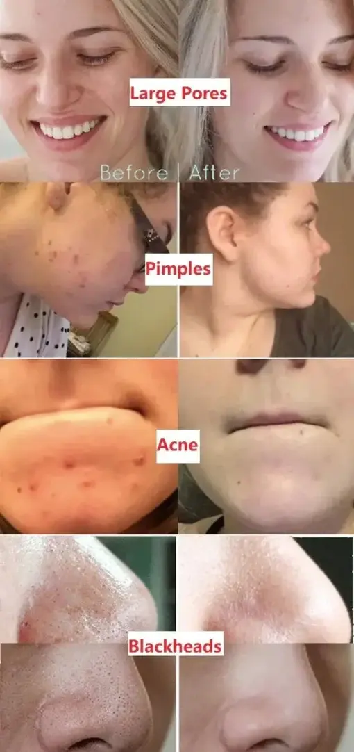 Fivfivgo™ Green Tea Detox Purifying Mask