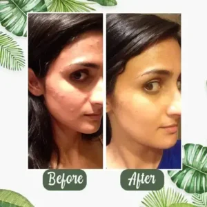 Fivfivgo™ Green Tea Detox Purifying Mask