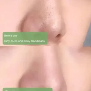 Fivfivgo™ Green Tea Detox Purifying Mask