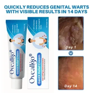 Fivfivgo® HPV Genital Warts ULTRA Relief Cream