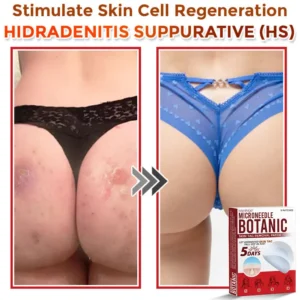 Fivfivgo® MicroNeedle Botanic Skin Tag Removal Patch 🇺🇸 Made in the USA