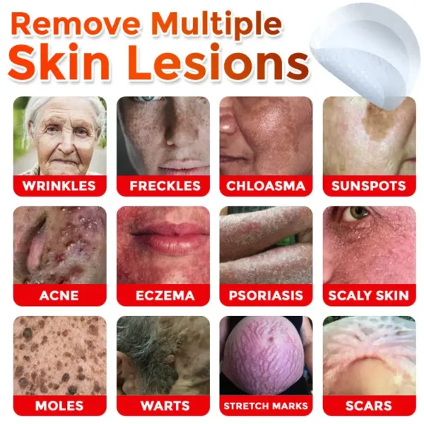 Fivfivgo® MicroNeedle Botanic Skin Tag Removal Patch 🇺🇸 Made in the USA