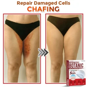 Fivfivgo® MicroNeedle Botanic Skin Tag Removal Patch 🇺🇸 Made in the USA
