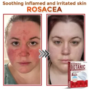 Fivfivgo® MicroNeedle Botanic Skin Tag Removal Patch