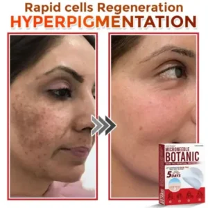 Fivfivgo® MicroNeedle Botanic Skin Tag Removal Patch