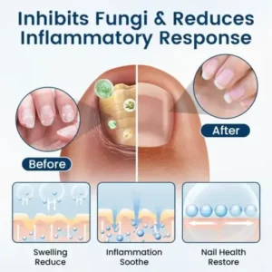 Fivfivgo® OnyxiGuard Fungal Repair Herbal Spray