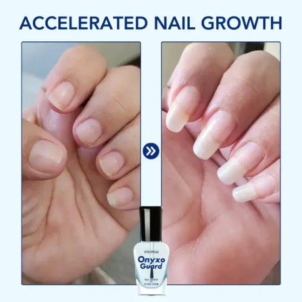 Fivfivgo® OnyxoGuard Nail Growth and Repair Serum