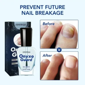 Fivfivgo® OnyxoGuard Nail Growth and Repair Serum