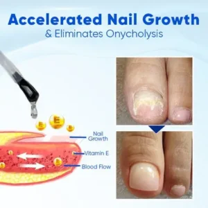 Fivfivgo® OnyxoGuard Nail Growth and Repair Serum