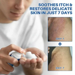 Fivfivgo® Advanced HPV & Rash Relief Genital Foam