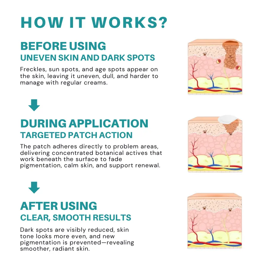 Fivfivgo® Botanical Freckles & Spot Removal Patch