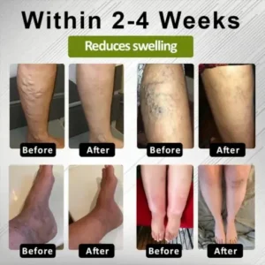 Fivfivgo® EdemaFree Flow Drain Massage Cream