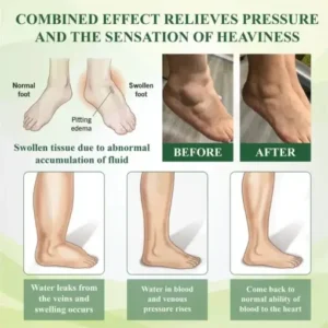 Fivfivgo® EdemaFree Flow Drain Massage Cream