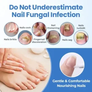 Fivfivgo® MycoErase Nail Revive Pen