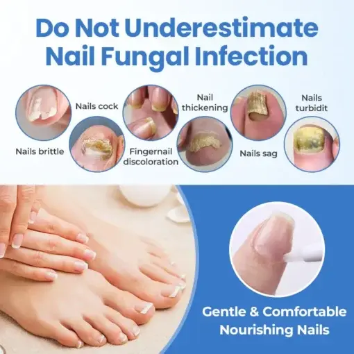 Fivfivgo® MycoErase Nail Revive Pen