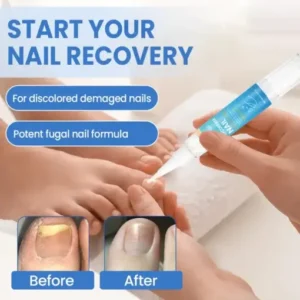 Fivfivgo® MycoErase Nail Revive Pen