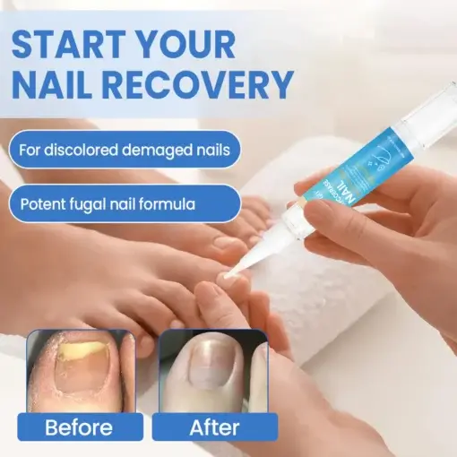 Fivfivgo® MycoErase Nail Revive Pen