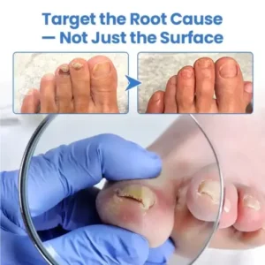 Fivfivgo® MycoErase Nail Revive Pen