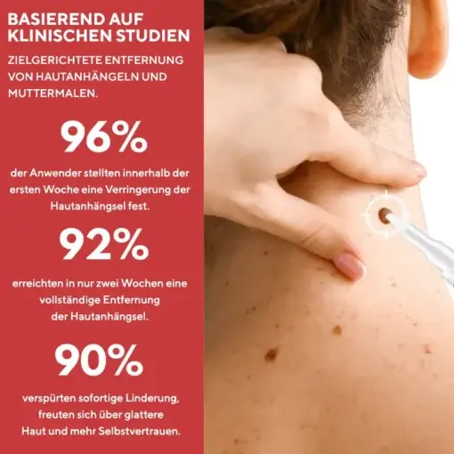 Fivfivgo® Stift zum Entfernen von Hautflecken und Leberflecken