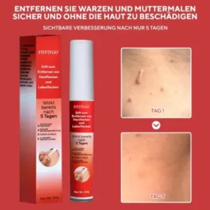 Fivfivgo® Stift zum Entfernen von Hautflecken und Leberflecken