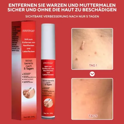 Fivfivgo® Stift zum Entfernen von Hautflecken und Leberflecken