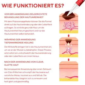 Fivfivgo® Stift zum Entfernen von Hautflecken und Leberflecken