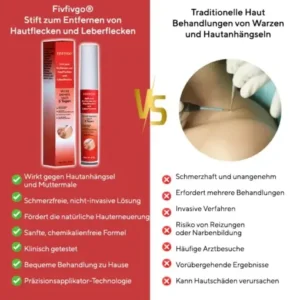 Fivfivgo® Stift zum Entfernen von Hautflecken und Leberflecken
