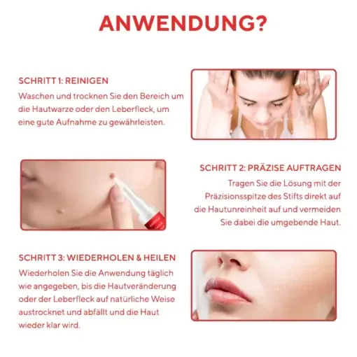 Fivfivgo® Stift zum Entfernen von Hautflecken und Leberflecken