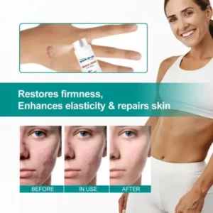 Fivfivgo™ Advanced Scar Removal Spray