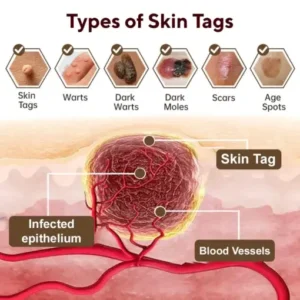 Fivfivgo® Black Rice Skin Repair Essence Cream