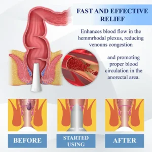 Fivfivgo® Hemorrhoid Treatment Gel